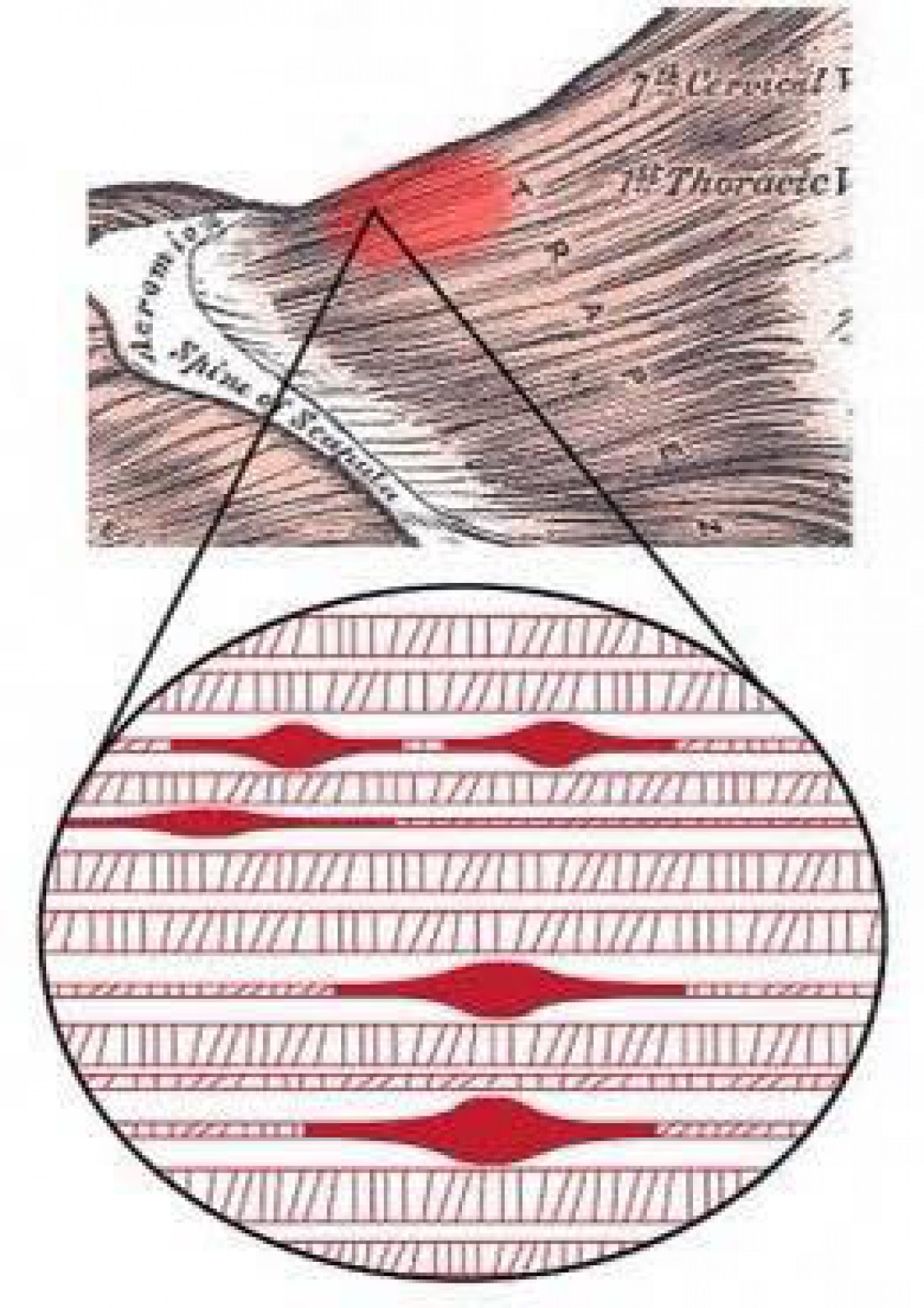 trigger-point-fit-d